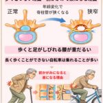 千歳船橋で腰椎脊柱管狭窄症の施術なら祐気堂マッサージ｜歩くと足がしびれる方へ