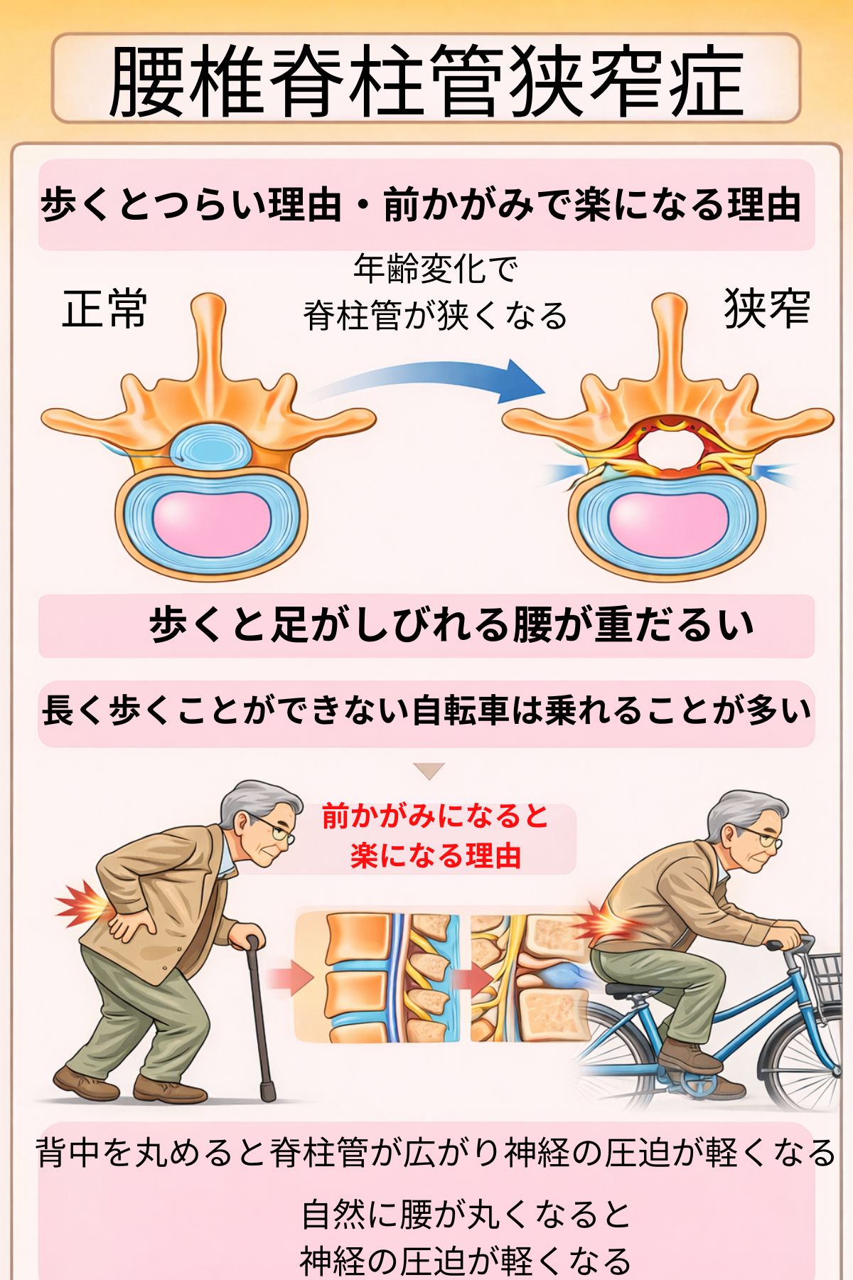 千歳船橋で腰椎脊柱管狭窄症の施術なら祐気堂マッサージ｜歩くと足がしびれる方へ