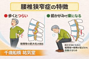腰椎狭窄症で歩くとつらい人へ｜楽になる歩き方