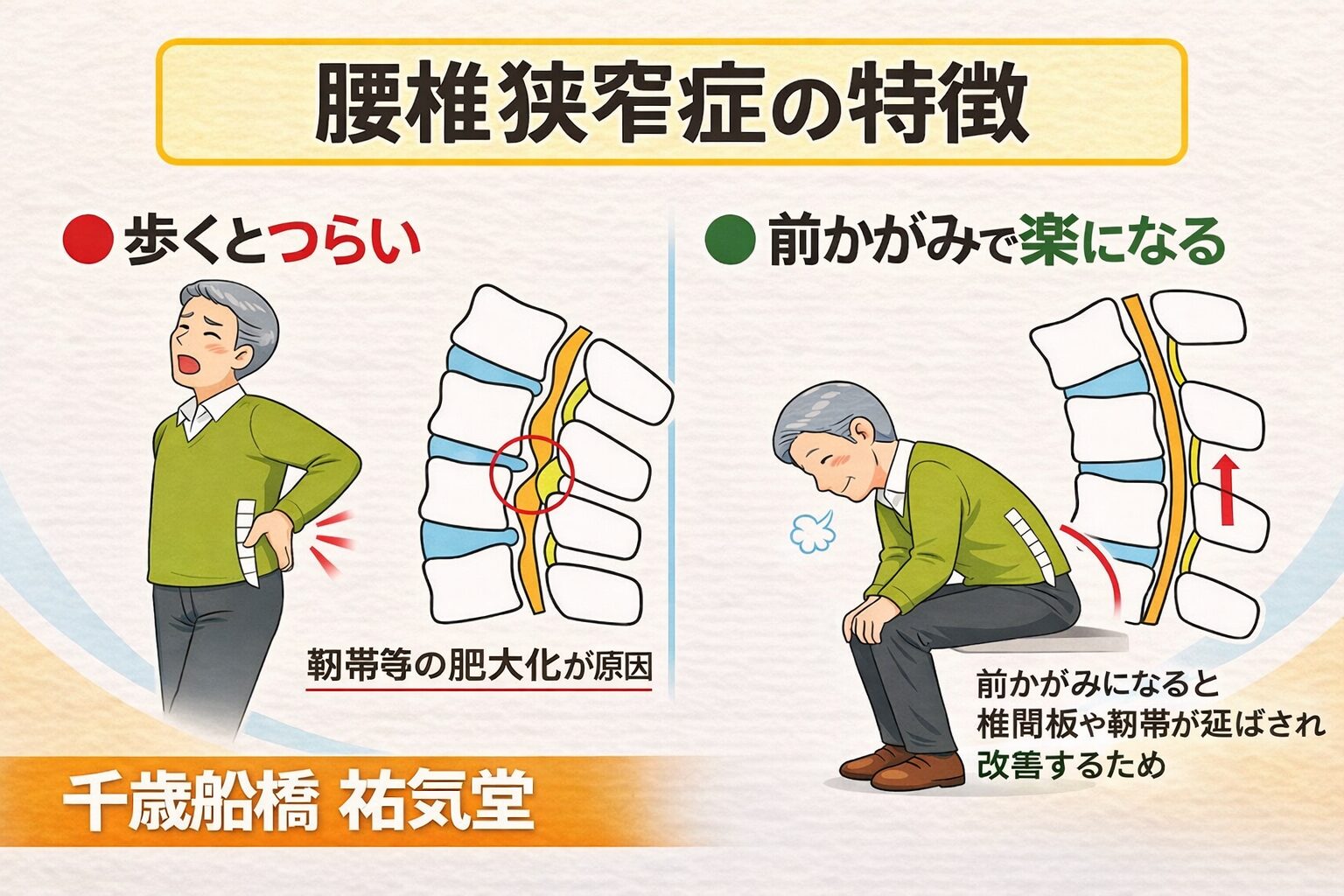 腰椎狭窄症で歩くとつらい人へ｜楽になる歩き方